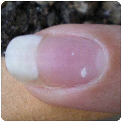 tache blanche ongle